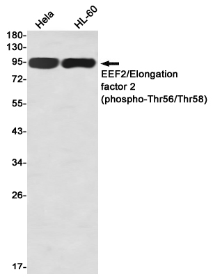 Anti-Phospho-Elongation Factor 2 (Thr56/Thr58) Rabbit mAb [60L56K10]
