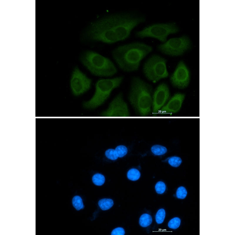 Anti-ATP Citrate lyase Rabbit mAb [52M87M20]