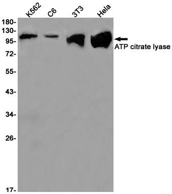 Anti-ATP Citrate lyase Rabbit mAb [52M87M20]