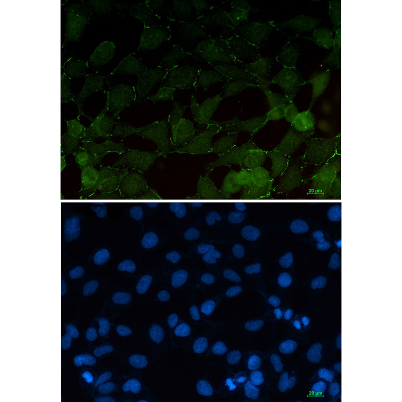 Anti-beta Catenin Rabbit mAb [41K66K10]