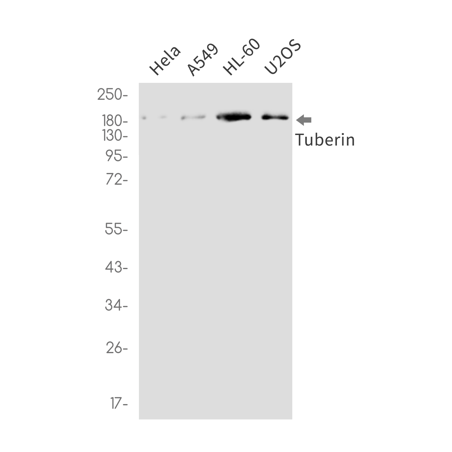 Anti-Tuberin Rabbit mAb [79M07L40]