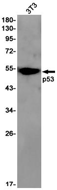 Anti-p53 Rabbit mAb [76K75K75]