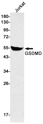 Anti-GSDMD Rabbit mAb [33K91L71]