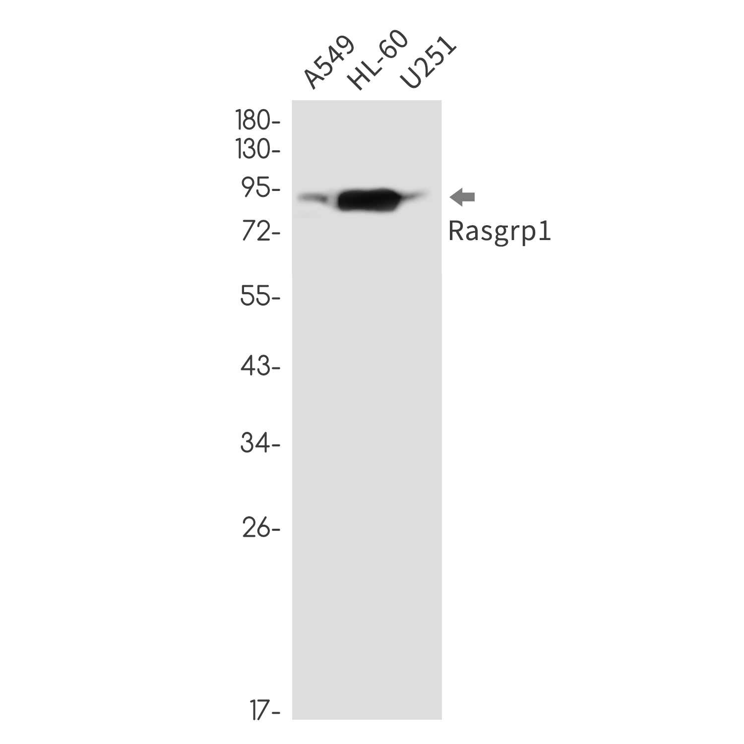 Anti-RASGRP1 Rabbit mAb [32K21K63]