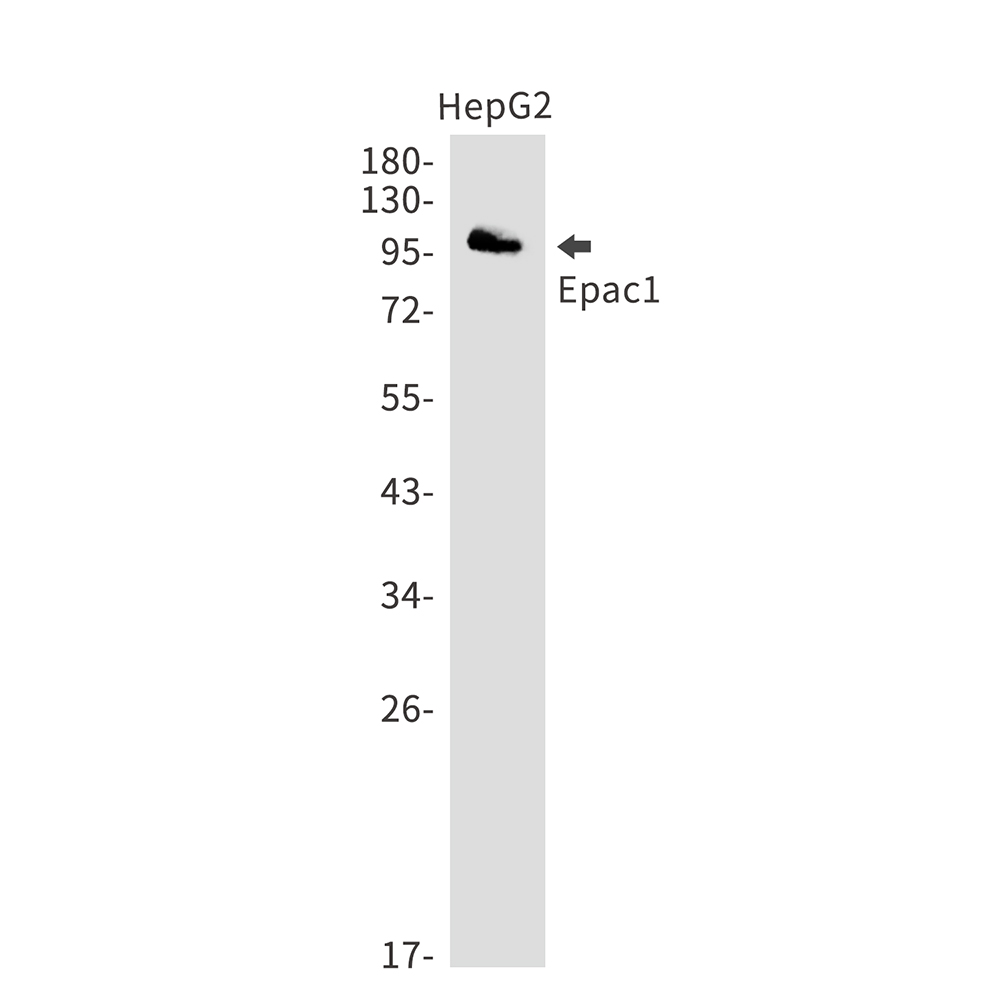 Anti-Epac1 Rabbit mAb [69L81L22]