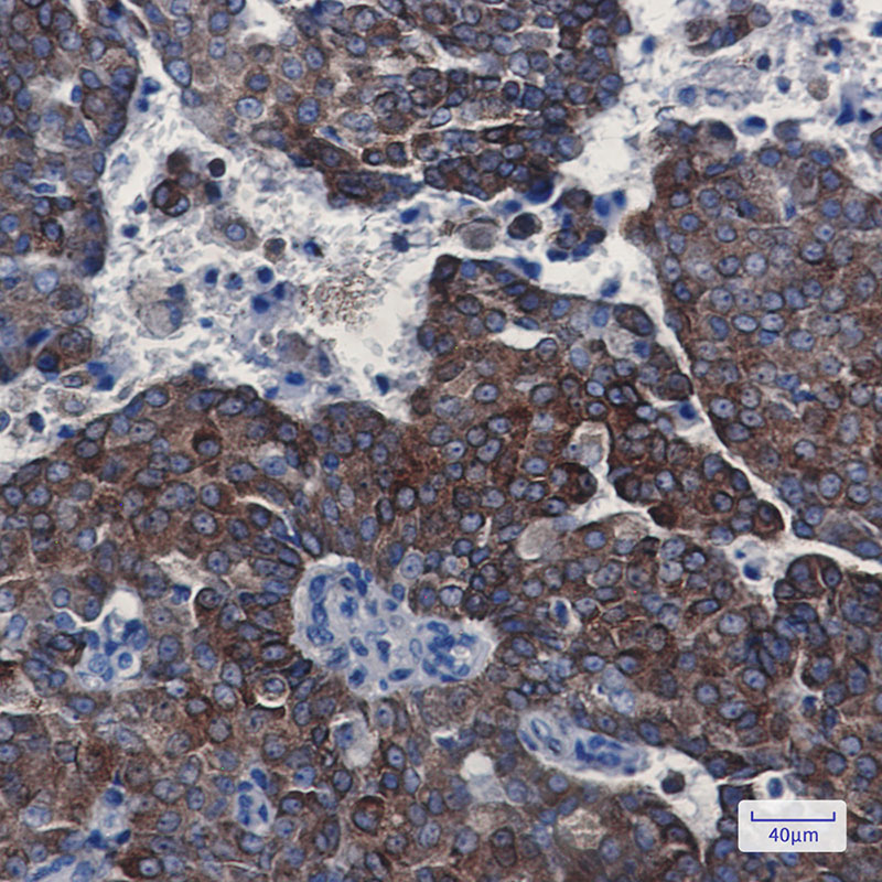 Anti-Bcl2 Rabbit mAb [74M56L90]