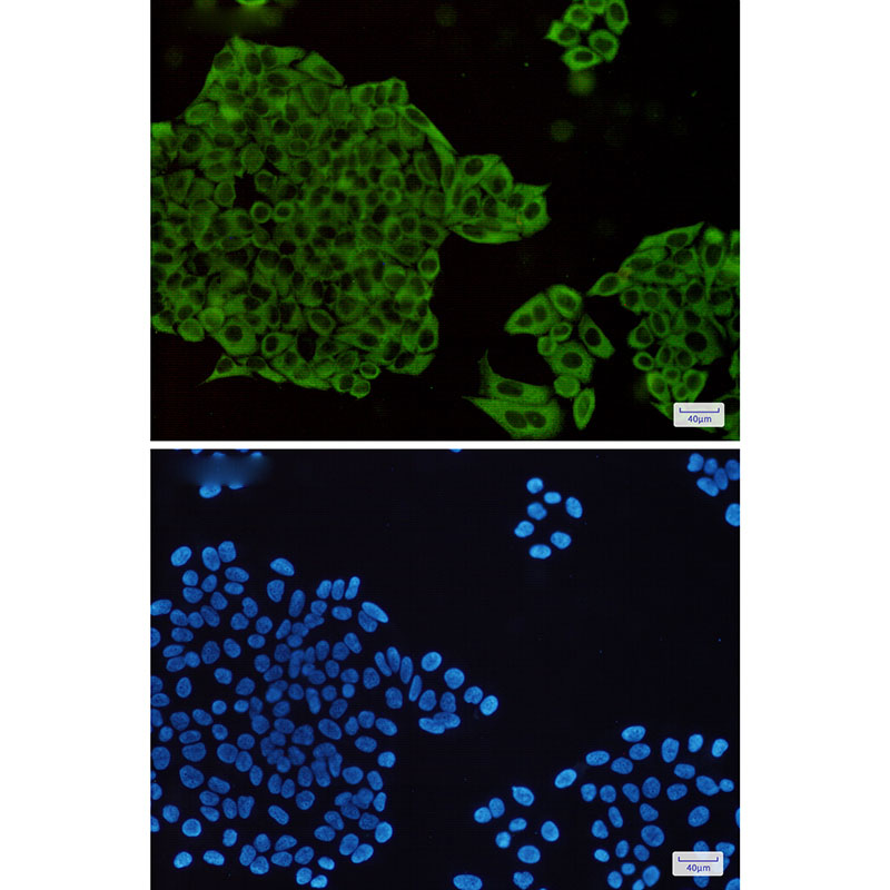 Anti-MEK1/2 Rabbit mAb [28M97L55]