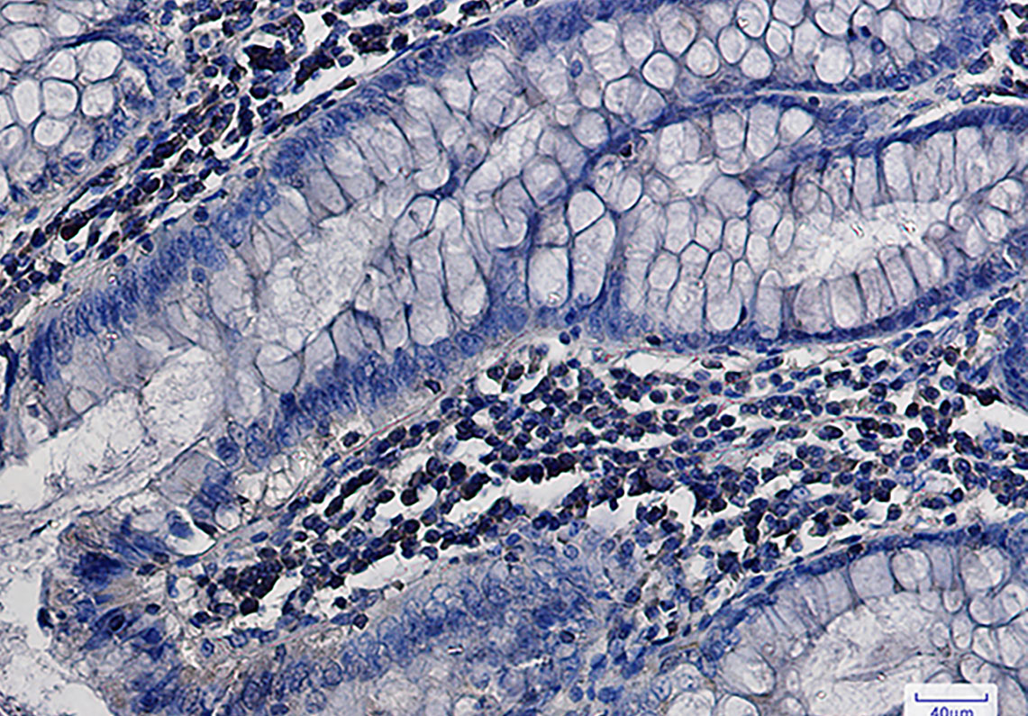 Anti-MEK1/2 Rabbit mAb [28M97L55]