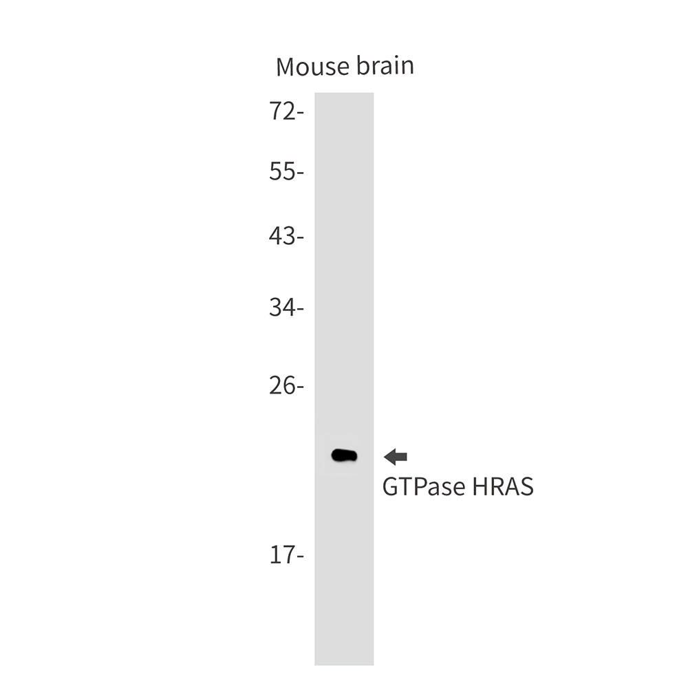 Anti-Ras Rabbit mAb [56M71K38]