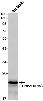Anti-Ras Rabbit mAb [56M71K38]