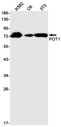 Anti-POT1 Rabbit mAb [83M88L37]