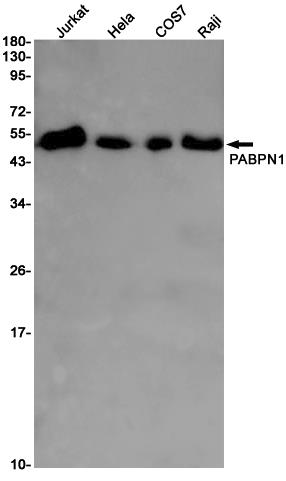 Anti-PABPN1 Rabbit mAb [89L80L42]