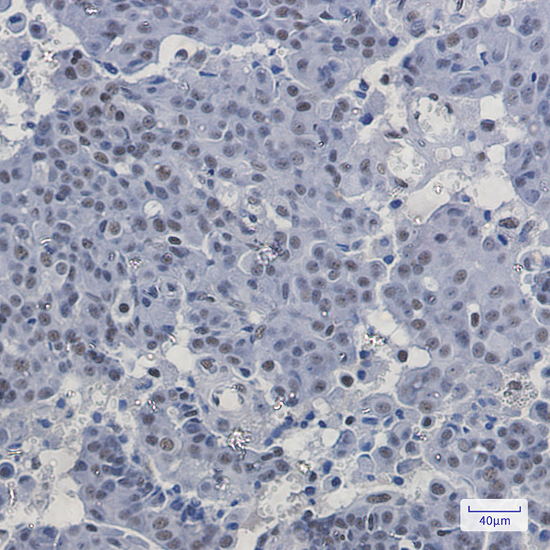 Anti-PABPN1 Rabbit mAb [89L80L42]