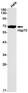 Anti-Hsp70 Rabbit mAb [55K63M10]