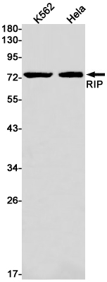 Anti-RIP Rabbit mAb [23M87K84]