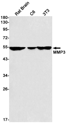 Anti-MMP3 Rabbit mAb [70K56K79]