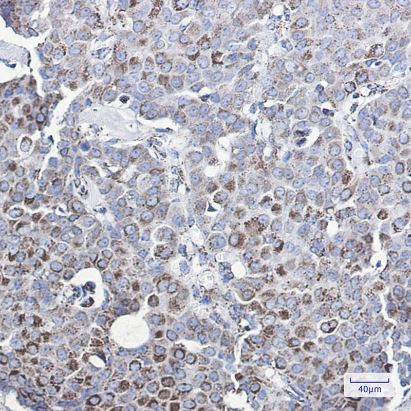Anti-MMP3 Rabbit mAb [70K56K79]