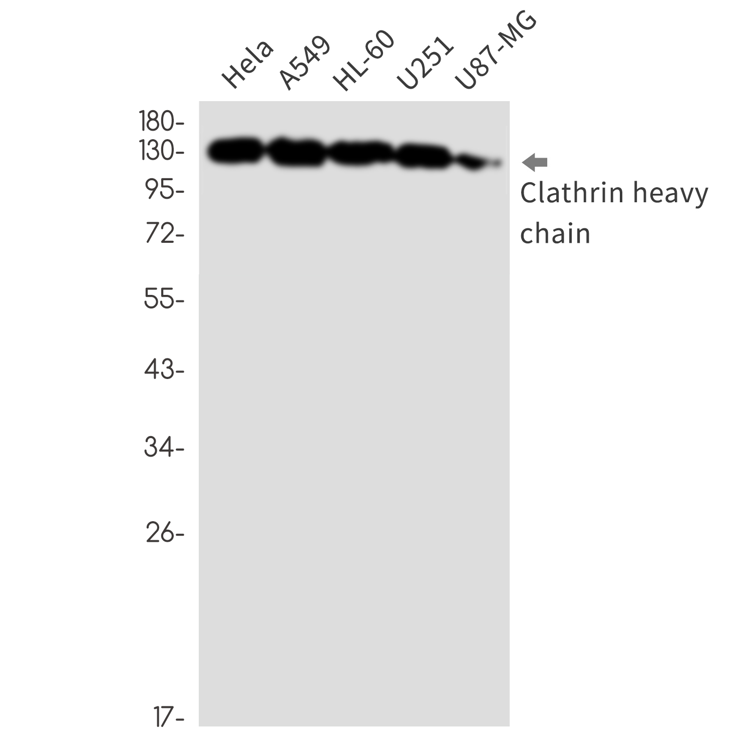 Anti-Clathrin Heavy Chain Rabbit mAb [92M88K34]