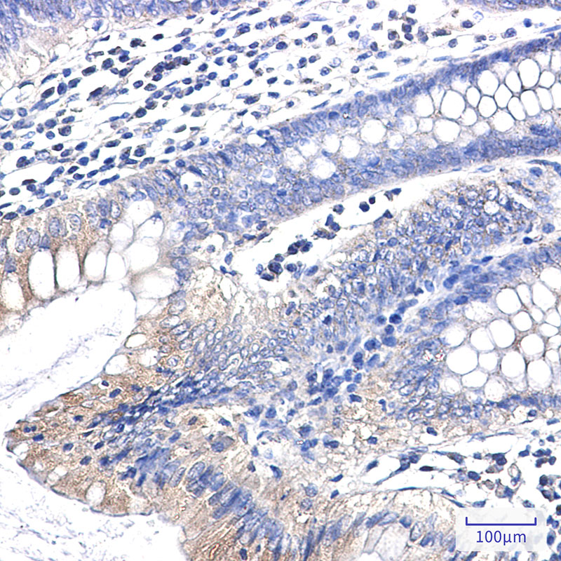 Anti-Clathrin Heavy Chain Rabbit mAb [92M88K34]