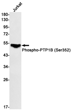 Anti-Phospho-PTP1B (Ser352) Rabbit mAb [89K94M90]
