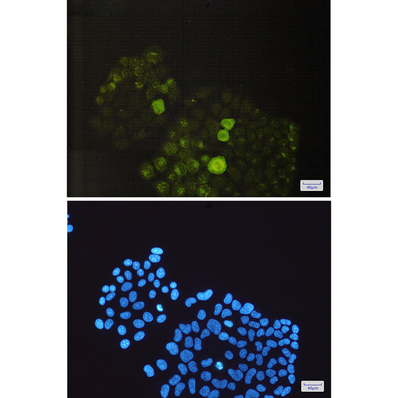 Anti-Phospho-PTP1B (Ser352) Rabbit mAb [89K94M90]