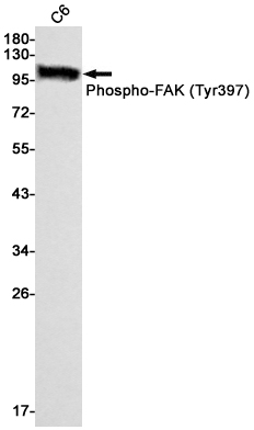 Anti-Phospho-FAK (Tyr397) Rabbit mAb [23L06L21]
