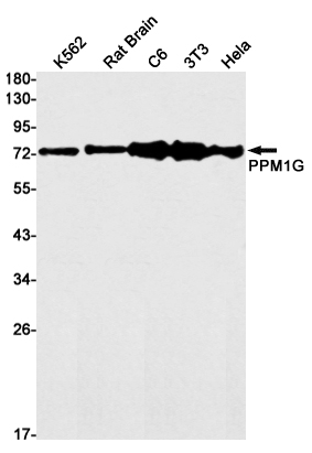 Anti-PPM1G Rabbit mAb [85L86L35]