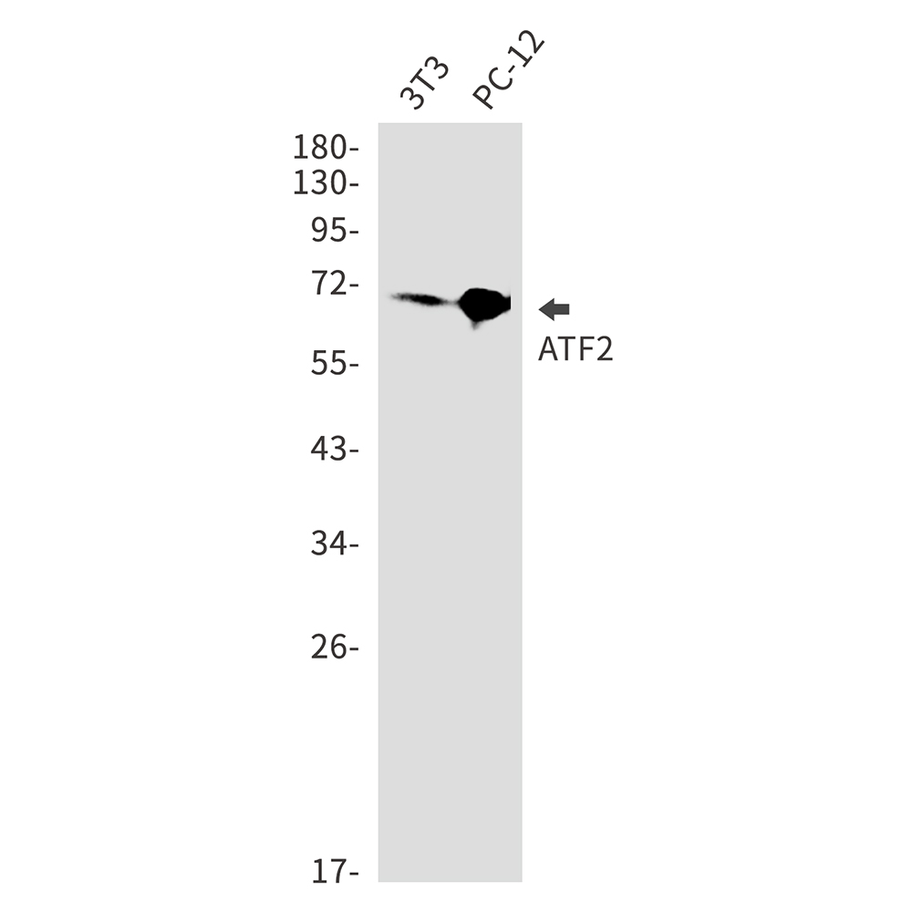 Anti-ATF2 Rabbit mAb [43M55K49]