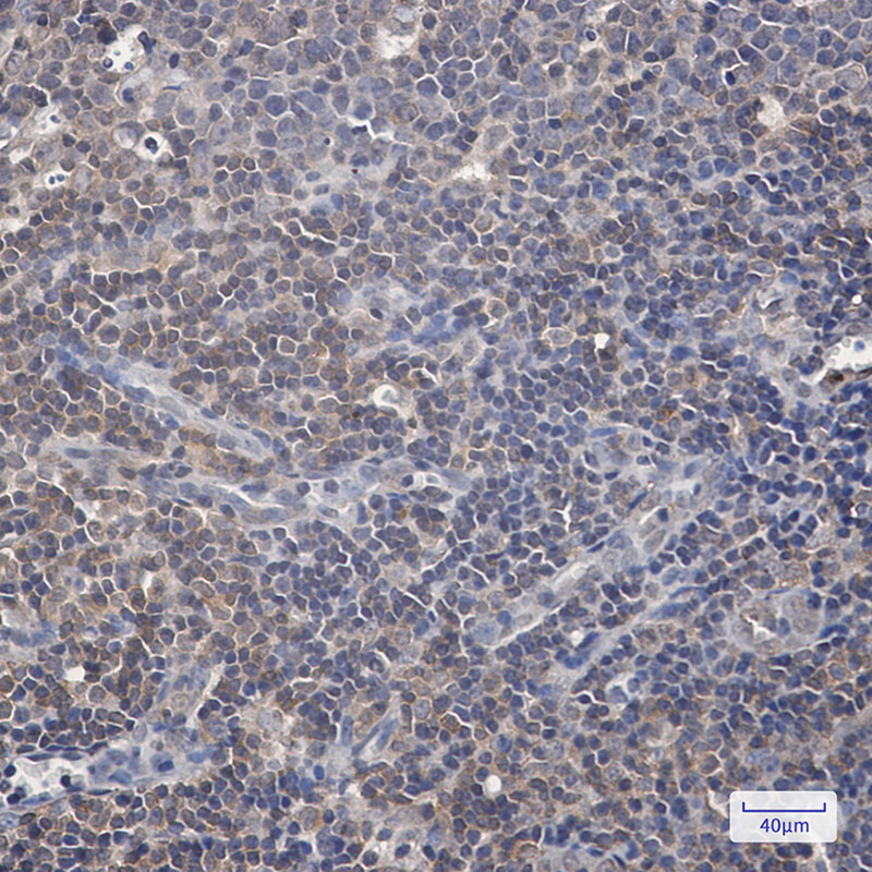 Anti-Phospho-Raf1 (Ser259) Rabbit mAb [69L67L72]