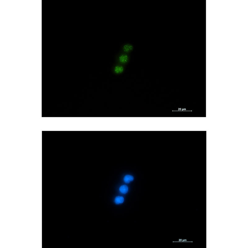 Anti-NXF1 Rabbit mAb [59L33M05]