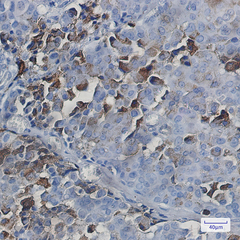 Anti-NXF1 Rabbit mAb [59L33M05]