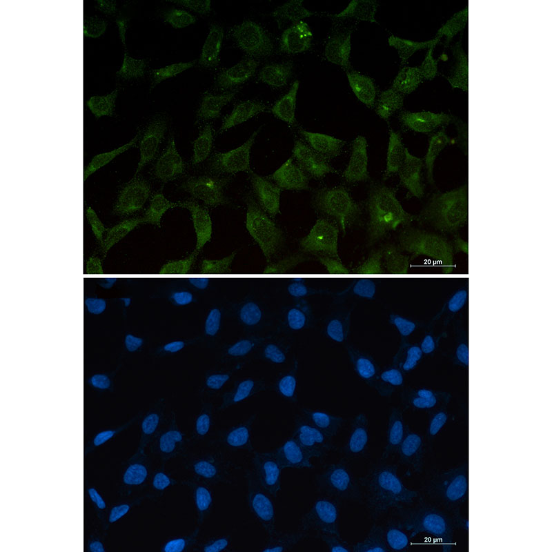 Anti-PUMA Rabbit mAb [19M73K38]