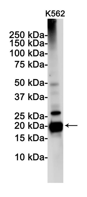 Anti-PUMA Rabbit mAb [19M73K38]