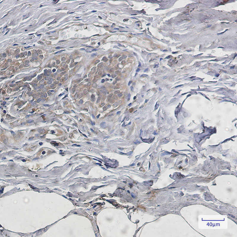 Anti-PUMA Rabbit mAb [19M73K38]