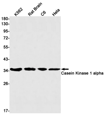 Anti-Casein Kinase 1 alpha Rabbit mAb [81L65K56]