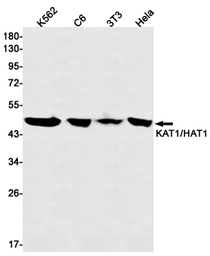 Anti-HAT1/KAT1 Rabbit mAb [78K78M16]