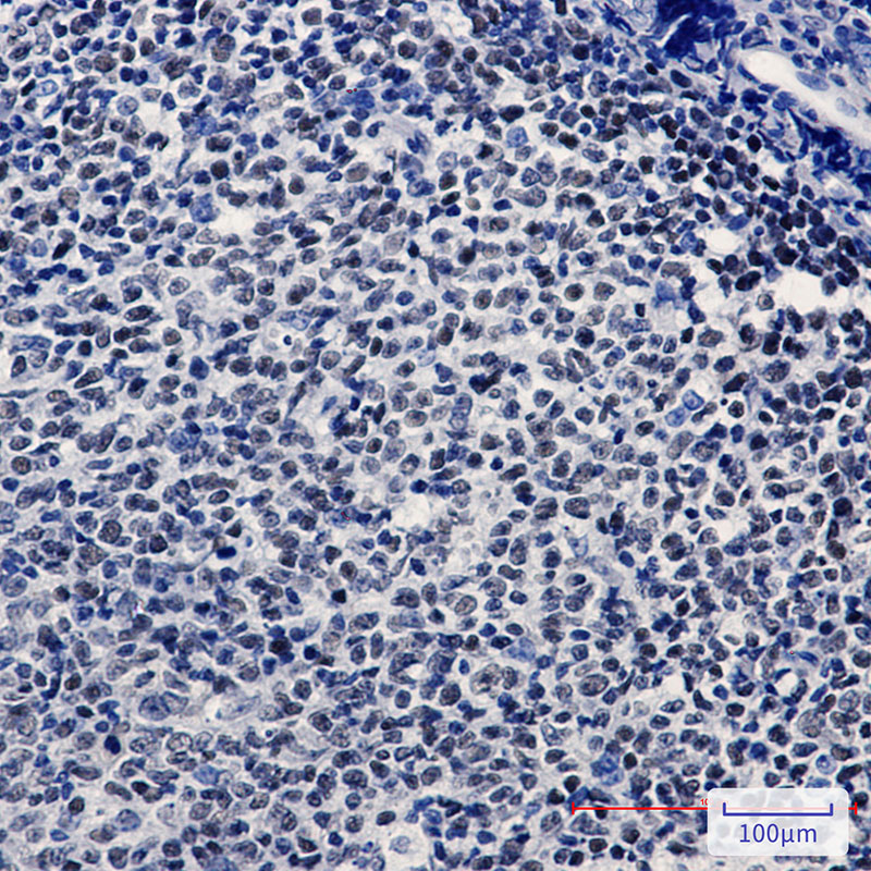 Anti-HAT1/KAT1 Rabbit mAb [78K78M16]