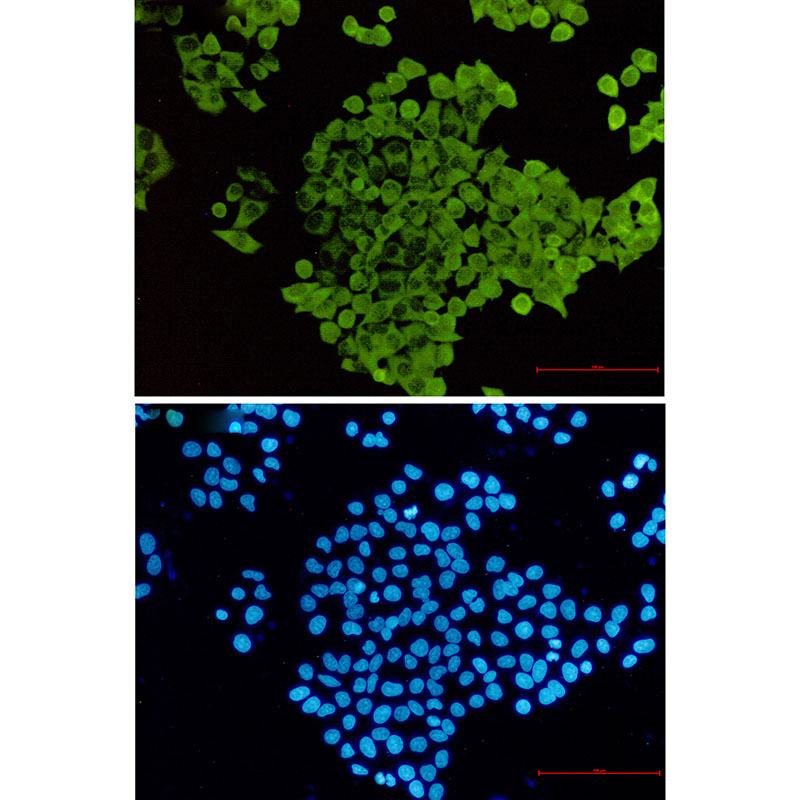 Anti-Cofilin Rabbit mAb [82K53L72]