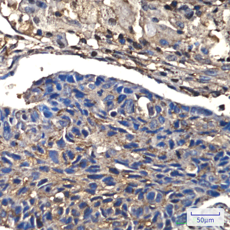 Anti-Cofilin Rabbit mAb [82K53L72]