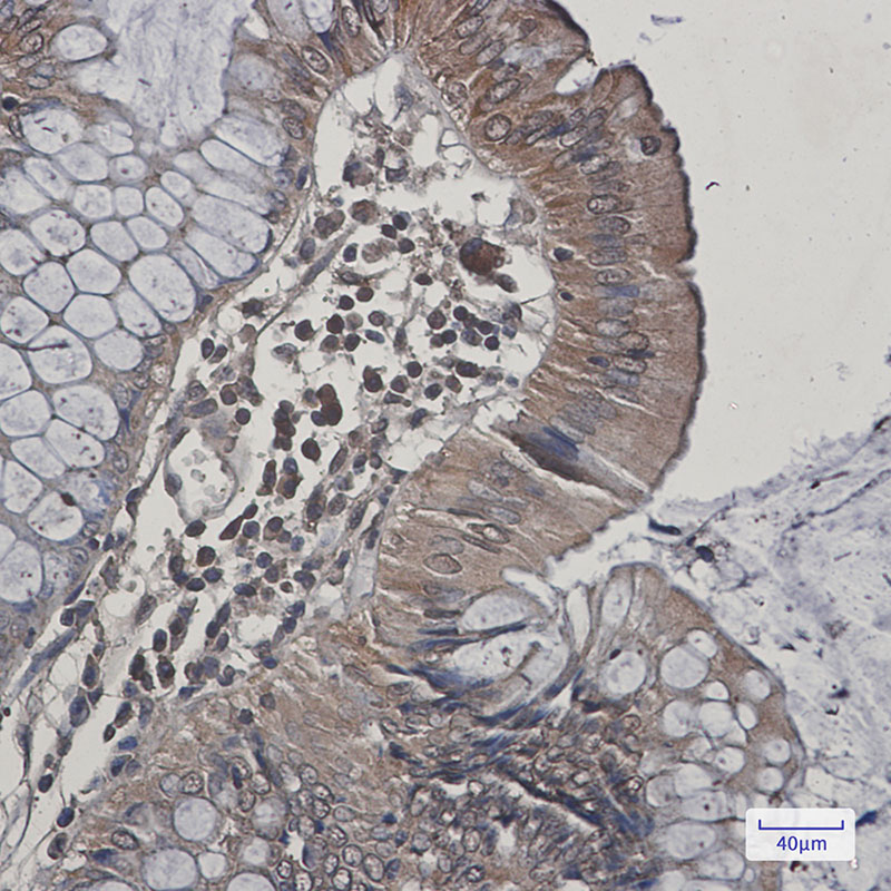 Anti-JNK2 Rabbit mAb [76K02L60]