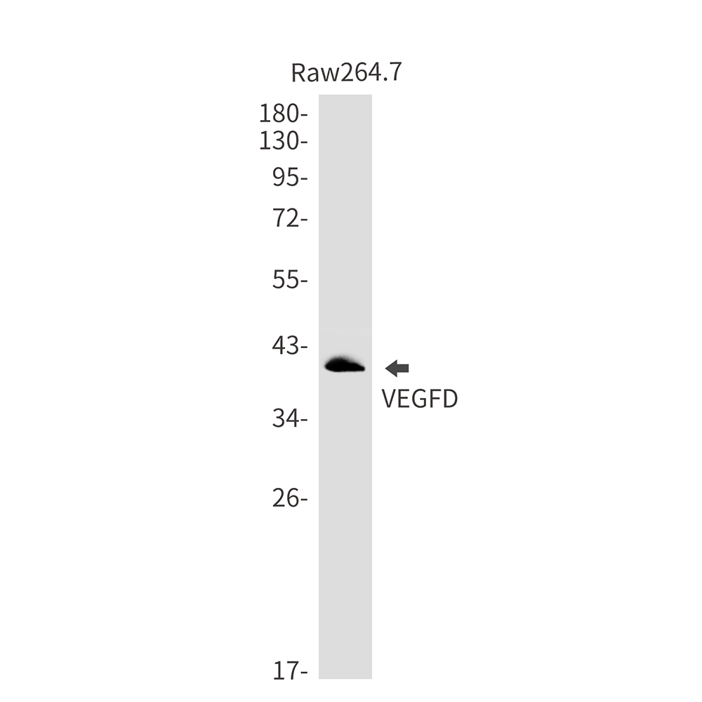 Anti-VEGFD Rabbit mAb [10M31K47]