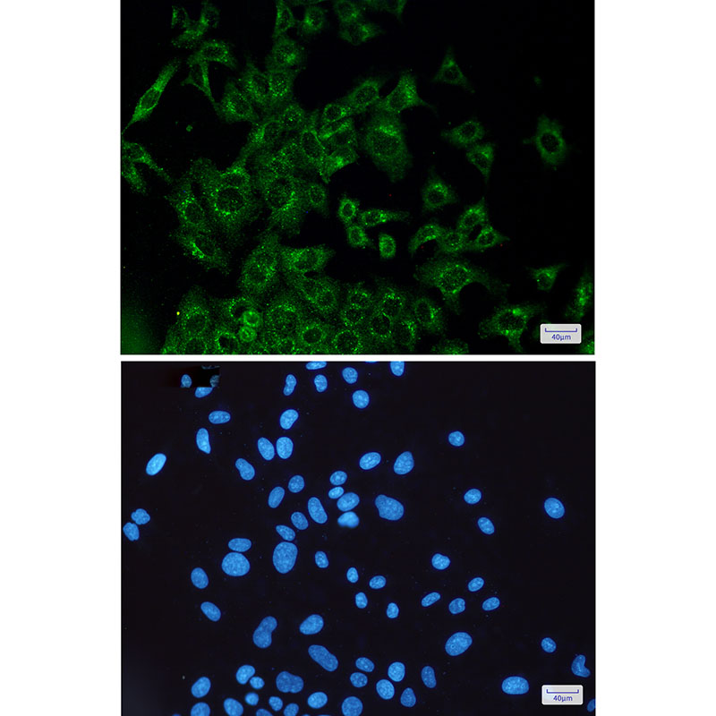 Anti-VEGFD Rabbit mAb [10M31K47]
