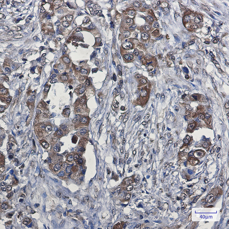 Anti-VEGFD Rabbit mAb [10M31K47]