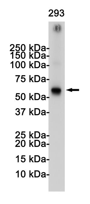 Anti-TRAF6 Rabbit mAb [45M21M42]