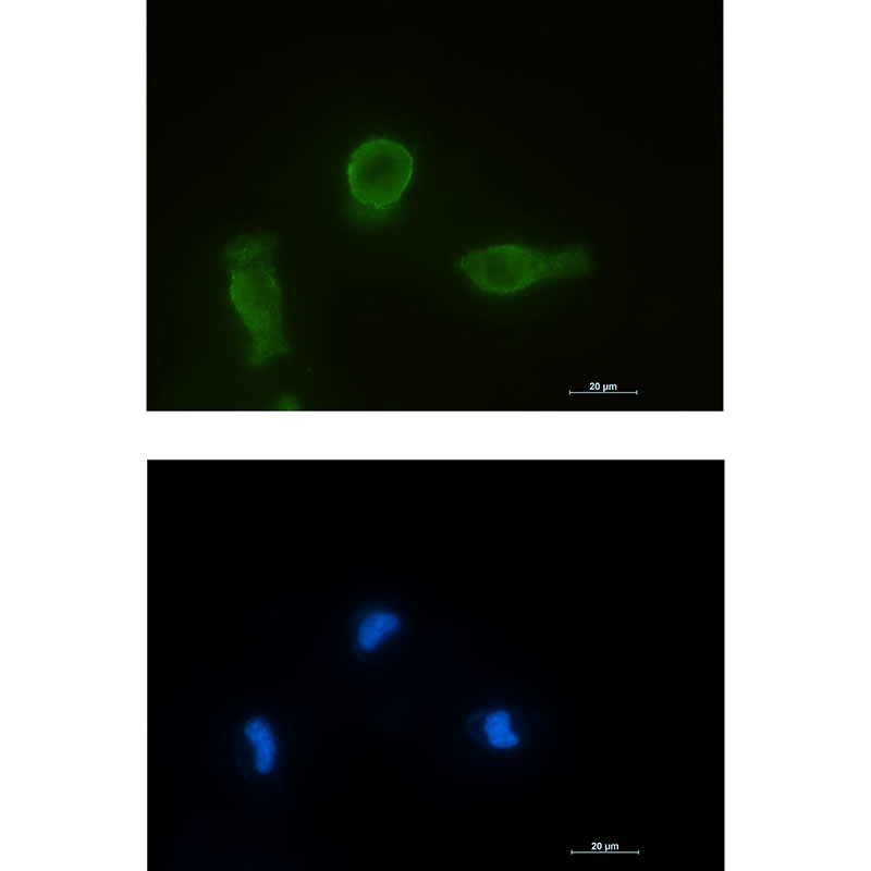 Anti-Bcl-XL Rabbit mAb [28L27K11]