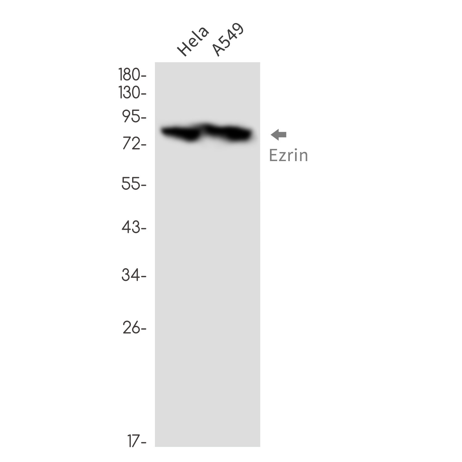Anti-Ezrin Rabbit mAb [38M49K15]