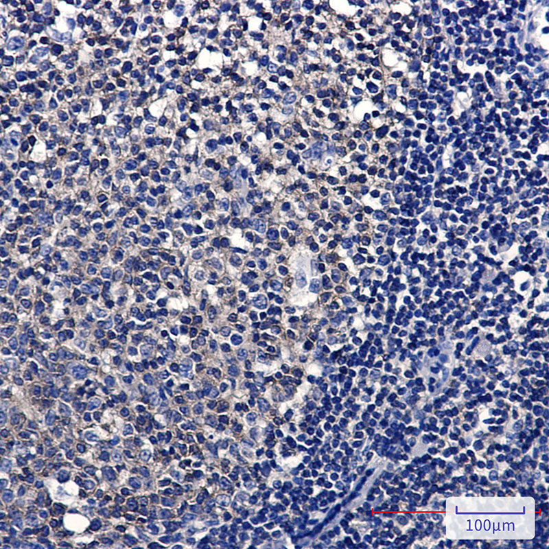 Anti-Ezrin Rabbit mAb [38M49K15]