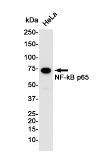Anti-NF-KB p65 Rabbit mAb [60L25L93]