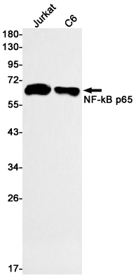 Anti-NF-KB p65 Rabbit mAb [60L25L93]