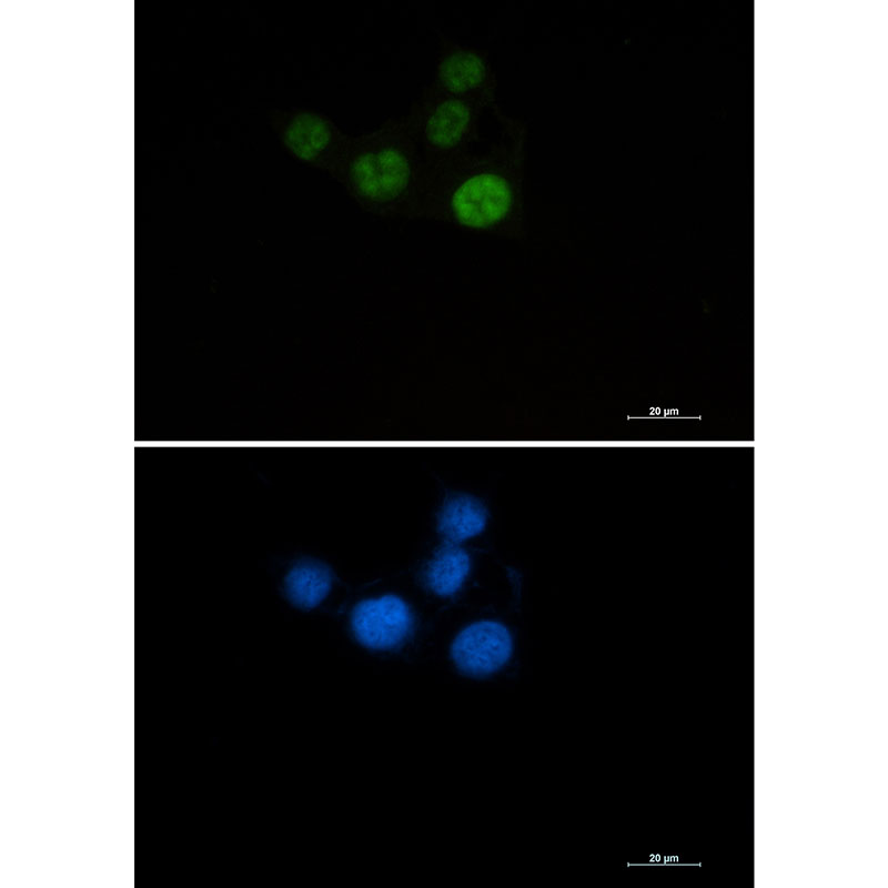 Anti-Chk2 Rabbit mAb [11L38K26]